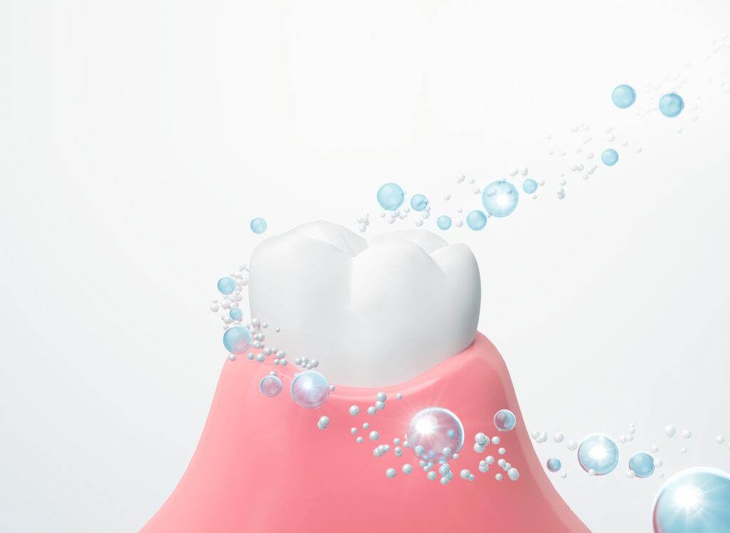 Fluoride Treatment Davie